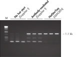 Effect of hot start on RT-PCR performance.
