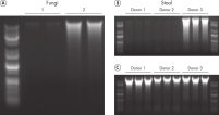 The new QIAamp PowerFecal Pro DNA Kit enables the isolation of larger amounts of high-quality DNA.