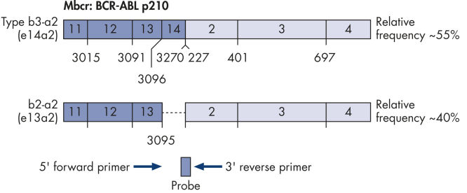 BCR-ABL Mbcr fusion gene transcript.