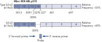 BCR-ABL Mbcr fusion gene transcript.